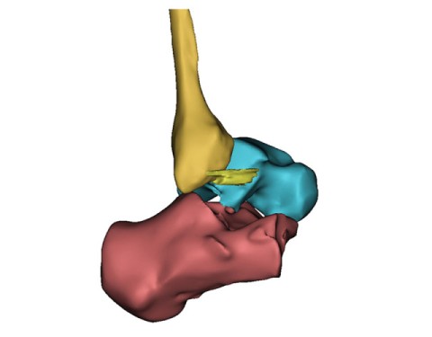 Pic 03: 3D reconstruction of 3D images of Tear